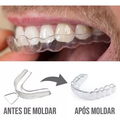 2 Pares (4 unidades) Moldeira Molde Clareamento Dental Clareador