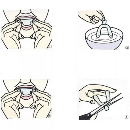 2 Pares (4 unidades) Moldeira Molde Clareamento Dental Clareador