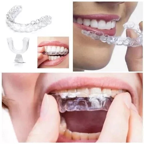 2 Pares (4 unidades) Moldeira Molde Clareamento Dental Clareador